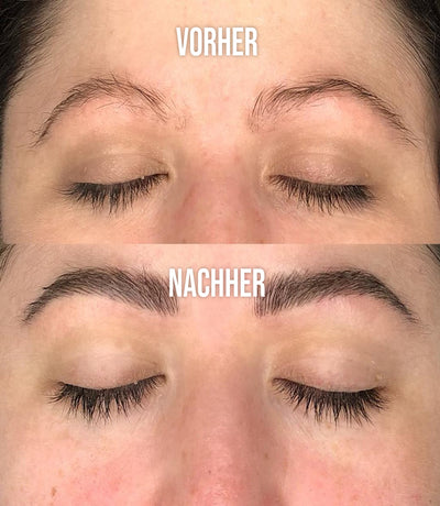 ForBrow Augenbrauenserum